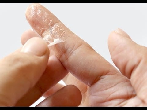 Trik Jitu Membersihkan Super Glue yang Menempel Di Tangan Anda